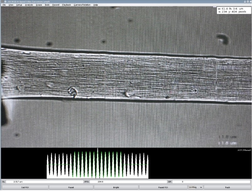 Figure 9. Single muscle fiber sarcomere striations shown in 901D HVSL.