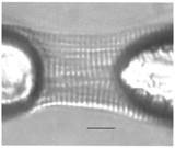 22-myocyte1